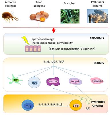 Severe Asthma and Allergy: A Pediatric Perspective